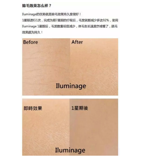 QQ截图20170816135451.png QQ截图20170816135451.png